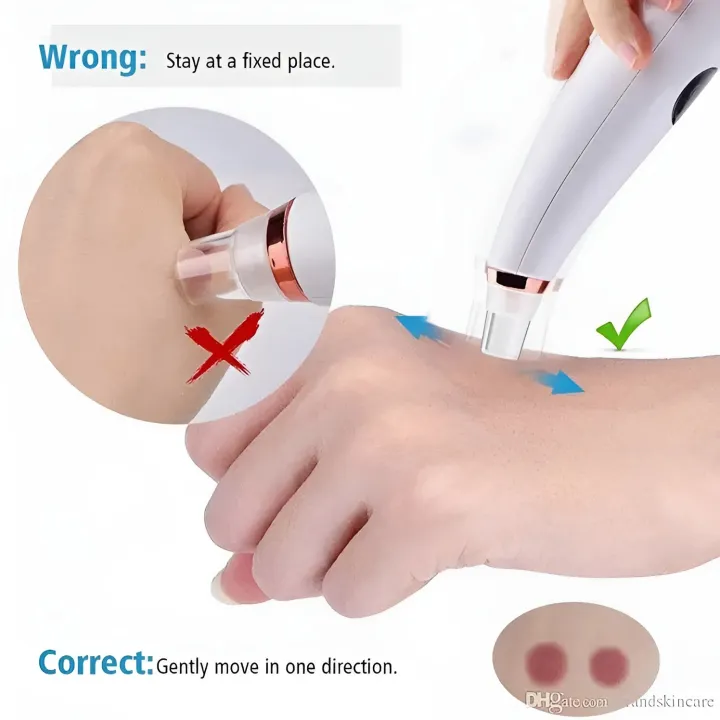 Multi-Functional Rechargeable Electric Blackhead Remover - Image 2