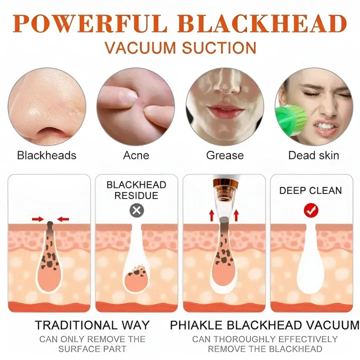 Multi-Functional Rechargeable Electric Blackhead Remover - Image 3